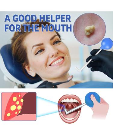 Tonsillenstein Remover | Effective Almond Stone Cupping Glass for Tonsil Stone Removal & Fresh Breath Oral Care - Buy Online on GoSupps.com
