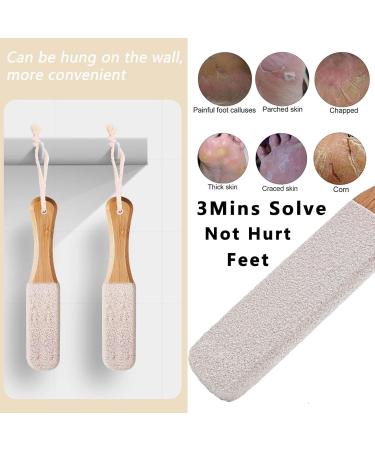 2 Pcs Pumice Stone for Feet Double Sided Pumice Stone Feet Hard Skin Remover Foot Files Scrubber Hard Skin Remover Foot Grater for Foot Cracked Heels Dead Skin Hard Skin (White) - Buy Online on GoSupps.com