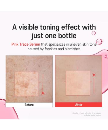 PDRN Serum TXA 5% Niacinamide 10% Pink Korean Skincare Dark Spot Hyaluronic Acid Vitamin B5 Panthenol Ceramide Uneven Skin Tone Radiant Complexion Glass Skin (30ml / 1.01 fl oz) - Buy Online on GoSupps.com