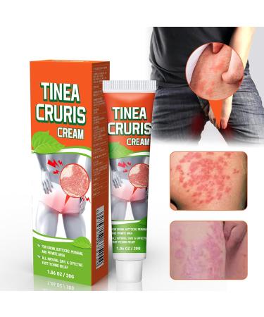 2 pieces herbal itch cream skin therapy cream dermatitis ointment moisturizing and caring effectively relieves itching and dryness of the skin suitable for men and women - Buy Online on GoSupps.com