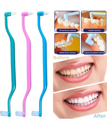 6-Piece 2-in-1 Toothbrush Set for Complete Oral Care | Interdental & Wisdom Tooth Brush Heads | Soft Dental Brushes for Braces & Between Teeth - Buy Online on GoSupps.com