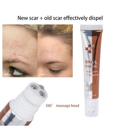 Scar Removal Gel 20g - Fast Penetration for Delicate Skin Repair & Growth - Daily Use Head Massage Cream - Buy Online on GoSupps.com