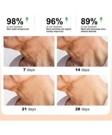  SOYDAN Lightening cream for throat skin - Gentle cream to moisturize dry throat skin - Winter beauty essentials for holidays dorms travel business trips - Buy Online on GoSupps.com