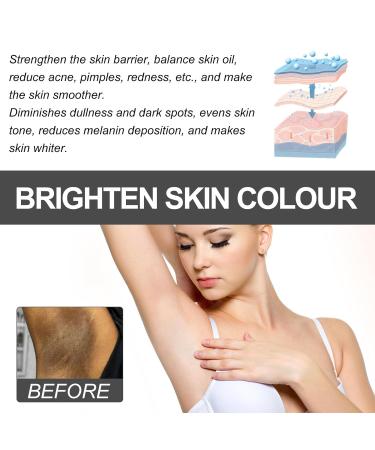 Crema Para Las Manchas De La Cara 2pcs 30ml Crema para manchas oscuras en la cara Cremas Para Las Manchas De La Cara Oscuras Para Piel Entrepierna Manchas Codos Piernas Zonas Rodillas Cuello - Buy Online on GoSupps.com