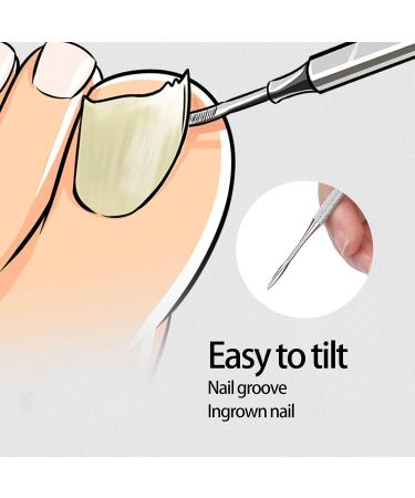 Ingrown Toenail Correction Tools Pain Relief Easy Use Ingrown Toenail Lifter Professional with Storage Box for Home for Paronychia - Buy Online on GoSupps.com