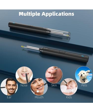 Ear Wax Removal Kit with 1080P Otoscope Camera and 8pcs Ear Picks - Ear Cleaner Camera for iPhone & Android - Buy Online on GoSupps.com