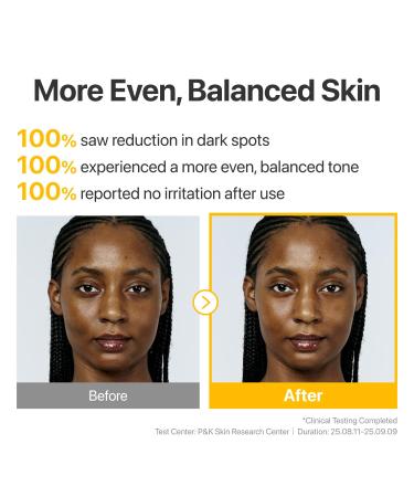 numbuzin No.5 Glutathione TXA Dark Spot Ampoule, Targeted Tone Care Concentrate for Dark Spots & Uneven Skin, Tranexamic Acid, Niacinamide, Vitamin Tree Water, Korean Skincare, 10.7g - Buy Online on GoSupps.com