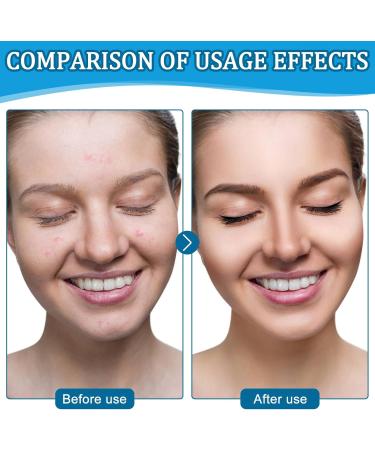 SPERMUOY B5 Facial Balm B5 Serum Repair Flavorful Facial Balm Moisturizing Moisturizing - Buy Online on GoSupps.com