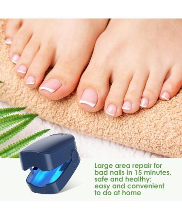 Home-Use Nail Fungus Laser Device with LED Blue Light Therapy - Buy Online on GoSupps.com
