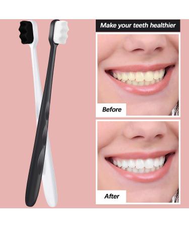 8-Piece Extra Soft Micro-Nano Toothbrush Set for Fragile Gums - Gentle Oral Care with 20000 Soft Floss Bristles - Bright Colors - Adult Size - Buy Online on GoSupps.com
