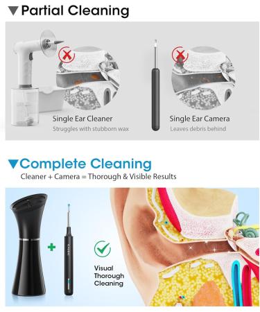 Ear Wax Removal Kit with Camera Ear Cleaner Tool for Safe & Effective Ear Care Includes Ear Camera for Visual Inspection & Gentle Ear Irrigation System Complete Ear Cleaning Solution Black - Buy Online on GoSupps.com