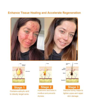 dooeka ADNOON 7-Day Multi-Effect All-in-One Skincare Cream Professional Bee Venom Skincare Cream All-in-One Skincare Cream Fine Line and Wrinkle Correction Cream for All Skin Types (2 Bottle) - Buy Online on GoSupps.com