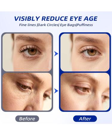 Eye Cream for Wrinkles & Crows Feet - with Essential Ceramides Peptides & Caffeine & Niacinamide - Reduce Puffiness & Bags Under Eyes Under Eye Cream for Women & Men 0.5 Oz Fragrance Free - Buy Online on GoSupps.com