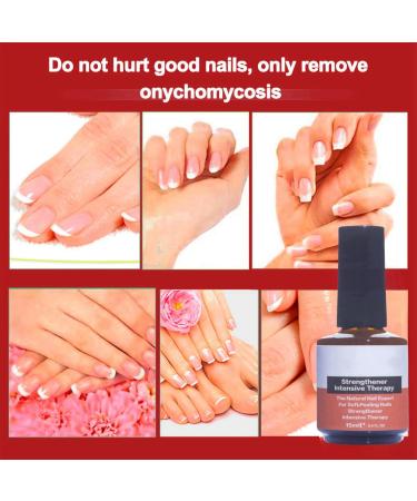 Nail Strengthening Treatment for Damaged Nails Nail Polish Strengthener Nail Hardner Oil Clear Nail Polish Strengthening Nail Growth and Strengthener Extreme Strength Nail Serum Nail Repair Serum - Buy Online on GoSupps.com