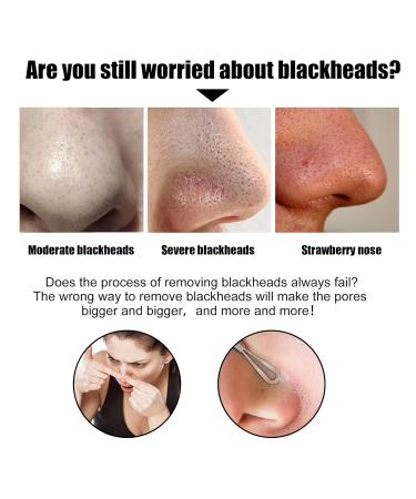 Effective Blackhead Remover Mask & Nose Strips for Clear Skin | International Shipping - Buy Online on GoSupps.com