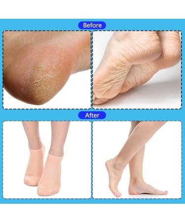 2 Pairs Moisturizing Socks Silicone Moisturizing Socks Anti Slip Aloe Socks for Dry Cracked Feet Women & Softening Dry Cracked Feet Rough Skins Calluses Spa Gel Socks Foot Care After Pedicure - Buy Online on GoSupps.com