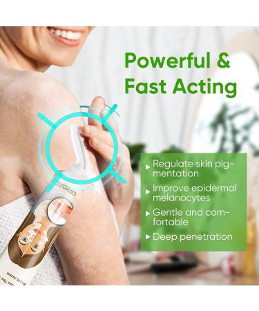 Natural Vitiligo Treatment Cream - Improve Skin Pigmentation & Reduce White Spots | Works on All Skin Types - Buy Online on GoSupps.com