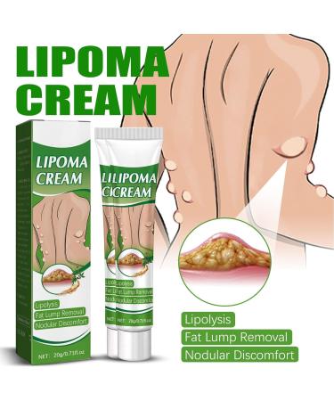 Delipidation Cream for Lipoma Removal and Anti-Swelling - Cellulite Ointment for Lipoma Lumps - Buy Online on GoSupps.com