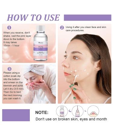 SIRUIMAO Stubborn Acne Drying Lotion - Overnight Acne Spot Treatment for Face & Body - 1 Fl Oz (Pack of 1) - Buy Online on GoSupps.com