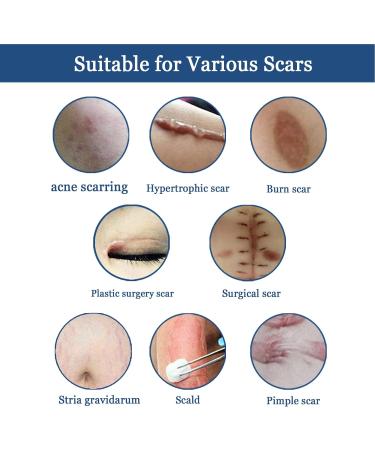 Skin Recovery Scar Gel for Women and Men - Effective Scar Removal Treatment - Buy Online on GoSupps.com