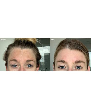 Dark Spot Corrector & Brightening Serum with Kojic Acid, Vitamin C, Salicylic Acid & More | Melasma Treatment Cream by Admire My Skin - Buy Online on GoSupps.com