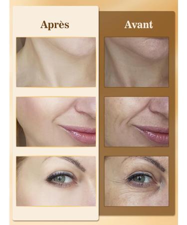 Anti-Wrinkle Facial Massager: Electric Double Chin Facial Massager 4 LED Colors EMS Thermal 45 C 3 Mode Lifting Massage  - Buy Online on GoSupps.com