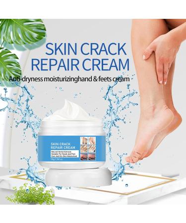 Foot Cream Callus Remover for Dry And Hard Skin Foot Nourishing Cream Deep Moisturizing Callus Remover and Soften Hard Skin Remover for Hand and Foot Care 50G - Buy Online on GoSupps.com