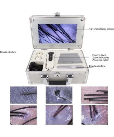 Scalp Hair Follicle Detector Skin Hair Scalp Detector 9 Inch Hd Screen Scalp Hair Follicle Tester Hair Follicle Facial Skin Oil Moisture Analyzer Used in Beauty Salons and Hair Care Salons - Buy Online on GoSupps.com
