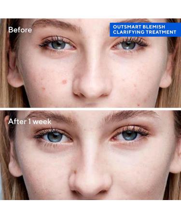 Murad Outsmart Blemish Clarifying Treatment 50ml - Buy Online on GoSupps.com