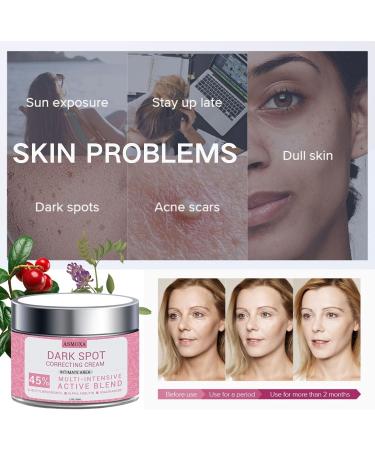 Skin Lightening Cream - Face Cream for Women - Dark Spot Corrector Remover - Face moisturizer for Anti Aging & Anti Wrinkles - Improve and Evens Skin Tone (50ml) - Buy Online on GoSupps.com
