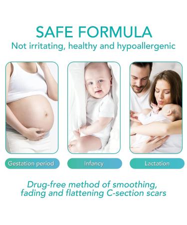 Silicone Scar Sheets - Professional Scar Removal Tape for C-Section, Surgery, Burn, Keloid, Acne - Soften and Flatten Scars - 1.6 x 120 - 3M Roll - Buy Online on GoSupps.com