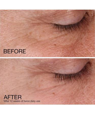 Neutrogena Rapid Wrinkle Repair Cream 1.7 oz - Anti-Aging Regenerating Moisturizer - Buy Online on GoSupps.com