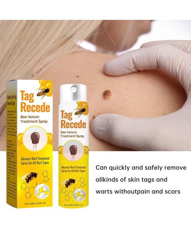 Uoqpty Wart Remover For Body Wart Remover Skin Lightening Fast Acting 20ml Natural Plant Extracts Painless For Men Women Legs Back Feet - Buy Online on GoSupps.com