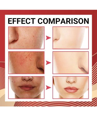 Acerola Cherry Skin Beautifying Essence Brightens Skin Tone Fades Dullness Moisturizes Moisturizes and Whitens Essence 15ml - Buy Online on GoSupps.com