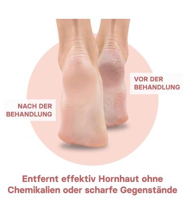 Valneo Pumice Stone for Corns - 2-Pack (69g Each) Natural Foot & Hand Care Tool - Buy Online on GoSupps.com