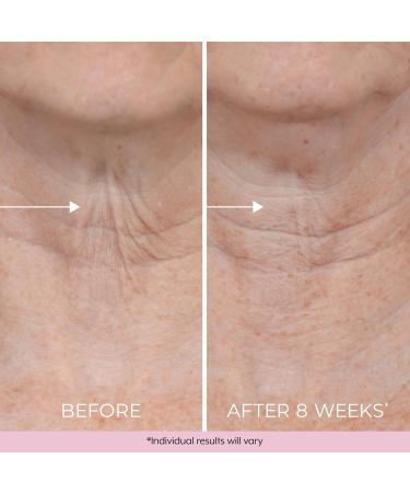 DEKLIDERM Neck Firming Cream Anti Aging Retinol Cream Visibly Reduces Neck Wrinkles and Sagging Neck Cream for loss of Firmness - Buy Online on GoSupps.com