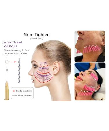 Phymat Moira PDO Fadenlift Kit - 40 Piece Full Body Lifting Set for Mother's Day | Mono Screw Smooth Type Face Lift Threads 29g*25mm - Buy Online on GoSupps.com