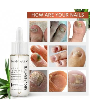 ILOVMUP Nail Cuticle Oil Nail Treatment for Dry & Damaged Nails Cuticle Care Oil for Fungal Nail & Toenails Strength Nail Oil for Moisturizing and Repairing Cracked Nail - 20ml - Buy Online on GoSupps.com
