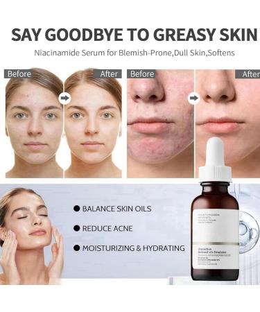 Face Moisturiser Retinoid 2% Emulsion Skincare Retinol Face Serum Anti Wrinkle Serum Retinol Face Serum Brightening Serum Brighten & Smooth Skincare Face Serum For Women & Men Serums Skincare - Buy Online on GoSupps.com