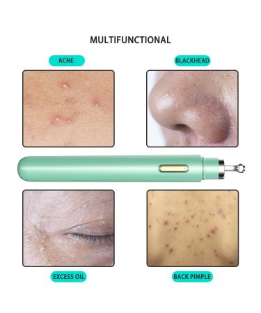 Womfenn Blackhead Remover 2022 - Advanced Pimple Popper with Camera | Acne Comedone Extractor Kit for Skin Care | Pore Clean Tool | 20X Zoom Aquamarine 01 - Buy Online on GoSupps.com