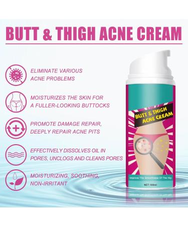 Shantou Yingji Shentiru Poacne cream acne cleansing cream for buttocks and thighs butt acne cream reduces acne acne cream for buttocks buttocks acne and pimples cleansing cream for pimples - Buy Online on GoSupps.com