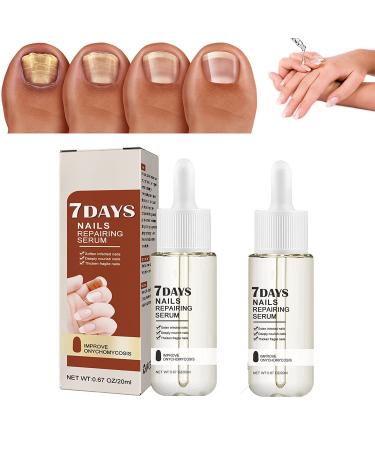DUBUSH GFOUK 7 Days Nail Growth Power Serum Nail Cuticle Oil Strengthener 1 Week Nail Strengthening Treatment Make Nails Grow Stronger and Healthier 2pcs