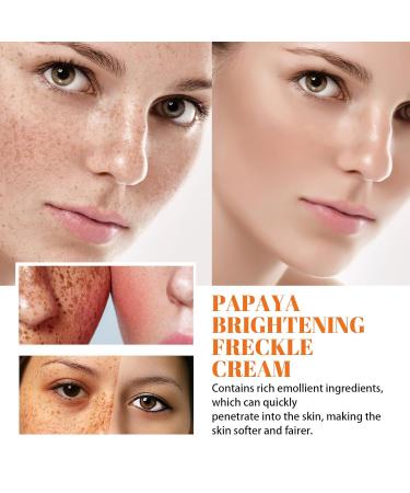 JOYVOIDX Daily & Night Cream for Face with Triethanolamine Niacinamide and Ascorbic Acid Moisturizing and Helps Improve Skin Feel 20g+20g - Buy Online on GoSupps.com