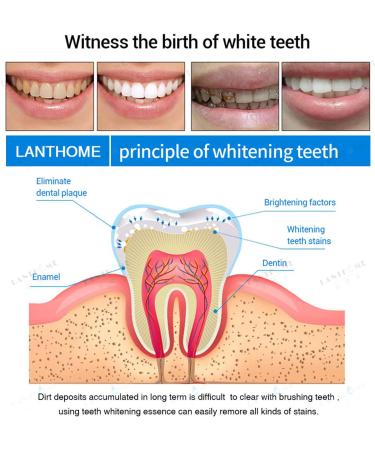 LANTHOME Teeth Whitening Kit: Herbaluxy Essence & Pen with Purely White Deluxe Formula - Nutty Buzzy Teeth Whitening Set - Buy Online on GoSupps.com