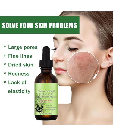 Rosemary Oil for Hair Growth Rosemary Essential Oil for Hair Care Eyebrow Eyelash Growth and Skin Care Natural Rosemary Oil to Treat Dry Damaged Hair Prevent Hair Loss Balance Grease with VE - Buy Online on GoSupps.com
