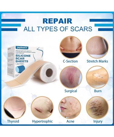 Scar Away Silicone Scar Sheets - 1.6 x 60 Roll - Surgical, C-Section, Keloid, Tummy Tuck, Burn, Stretch Marks - Reusable Scar Removal Strips - Buy Online on GoSupps.com