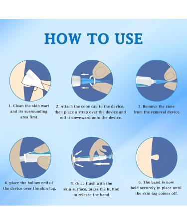 Ultimate Skin Tag Remover Kit | Fast & Effective Warten Removal Tool for Fibroma & Wart Treatment | 60 Skin Tags (1mm-8mm) - International Shipping Available - Buy Online on GoSupps.com
