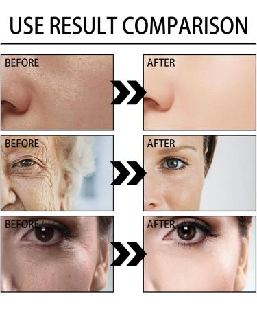 KOAHDE Snail Collagen Face Cream Snail Essence Face Cream Snail Anti Wrinkle Face Cream Snail Hyaluronic Cream Snail Moisturizing Cream Snail Brighten Face Cream Snail Firming Face Cream 100G - Buy Online on GoSupps.com