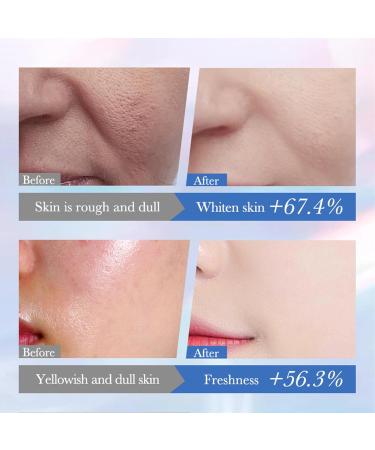 Niacinamide Brightening Face Cream Dry Skin Moisturiser - Whitening Cream for Face Acne Moisturiser Dark Spot Cream Niacinamide Day Cream for Dry Skin Prone to Blemishes - Radiance & Glowing Skin - Buy Online on GoSupps.com