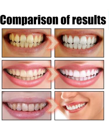 Cocofresha Pulling Oil Cocofresha Organic Coconut Pulling Oil Cocofresha Pulling Oil for Teeth and Gums Coconut Oil Pulling for Teeth (1pcs Cocofresha) - Buy Online on GoSupps.com